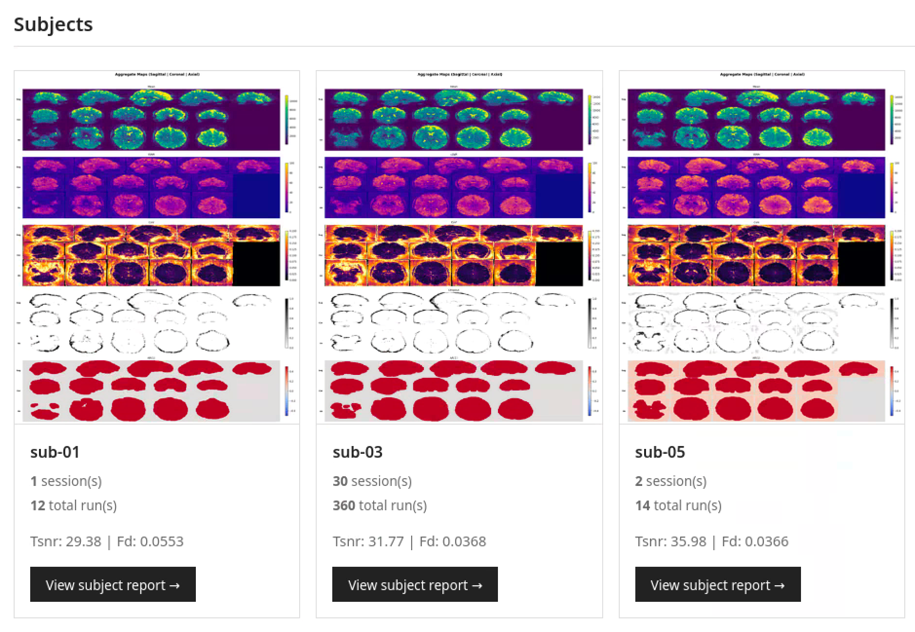 fMRI quality assurance report interface